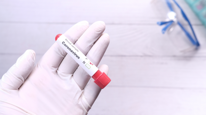 Symbolbild: Positiver Corona-Test