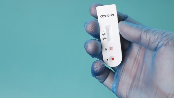 Schnelltest- Bild: Tim Reckmann/CC BY 2.0