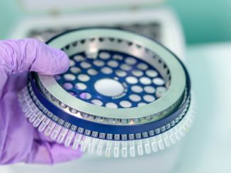 Bundesweite Sieben-Tage-Inzidenz auf 1465,4 gestiegen