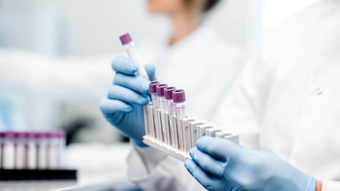 flash_up_symbolbild_ - 2022-01-19T181531.035 PCR-Test