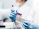 Patientenschützer fordern Vorrang bei PCR-Tests auch für vulnerable Menschen