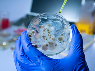 Studie: 1,2 Millionen Menschen starben 2019 durch multiresistente Erreger