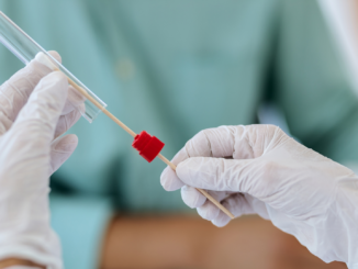 Faktencheck: Setzen US-Behörden nicht mehr auf PCR-Tests in der Corona-Pandemie?