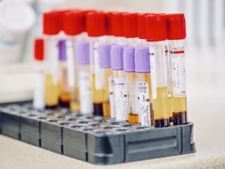 Jeder dritte Erwachsene in Dänemark vermutlich in Omikron-Welle infiziert