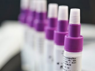 Ärzteverbände für Ende der kostenfreien Corona-Bürgertests