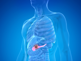 Bauchspeicheldrüsentumore: Erlanger Chirurgen finden Biomarker, mit dem sich Krebs von gutartigen Erkrankungen unterscheiden lässt
